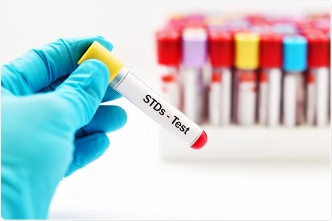 STD Testing: What is the Right Choice For You?