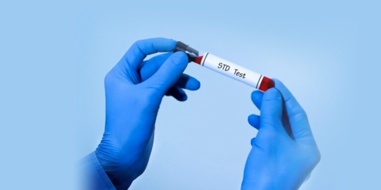 How long do STD screening results take?