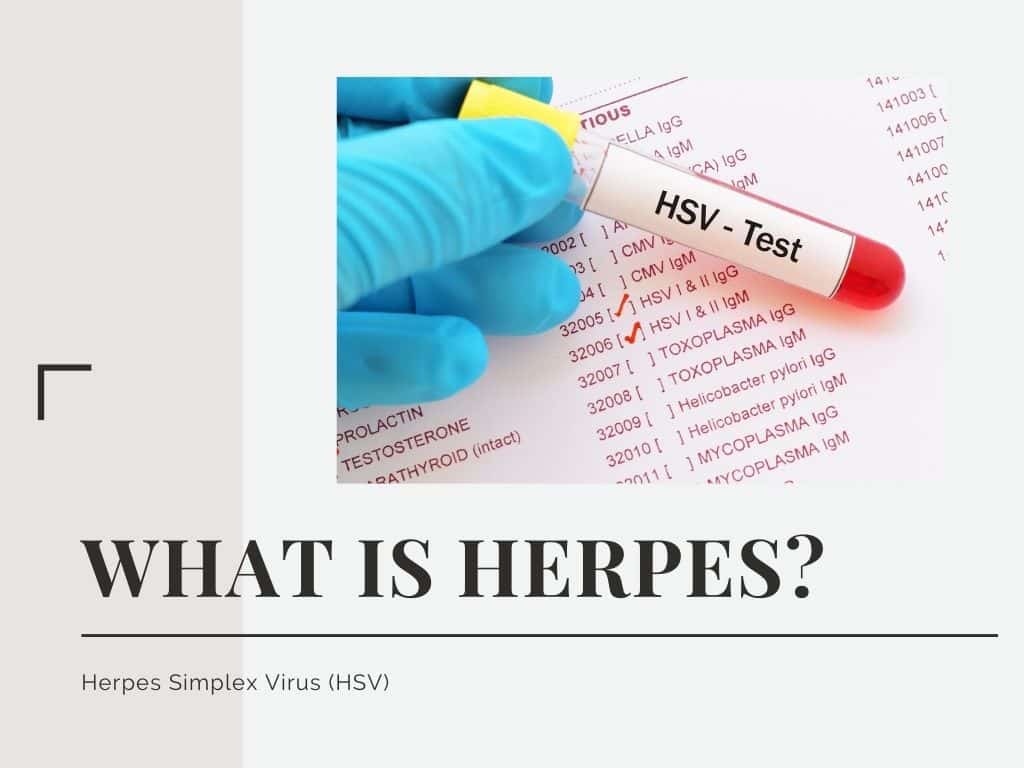 what-you-need-to-know-about-herpes-or-hsv-healthsoul