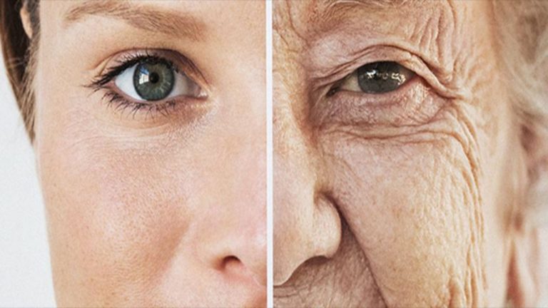 STDs vs. Normal Aging